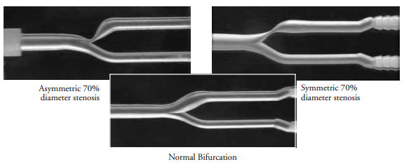 湾边供应加拿大 Intracranial Anthropomorhpic Vascular Phantom, 颅内血管模体